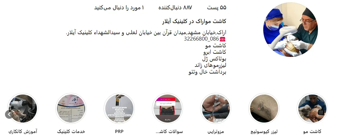 بهترین دکتر کاشت مو در اراک باید رزومه و سابقه و مهارت کافی داشته باشد