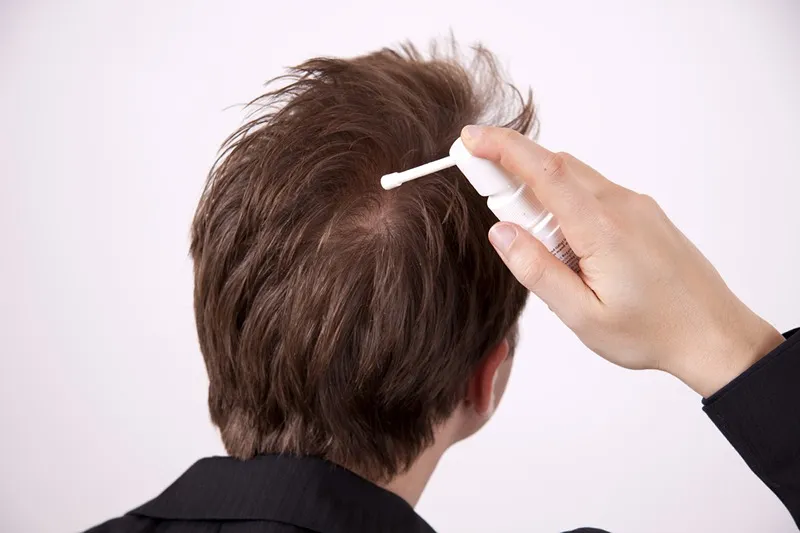 اسپری آب و نمک نیز تاثیر بسزایی در خارش یر بعد از کاشت مو ایفا میکند.