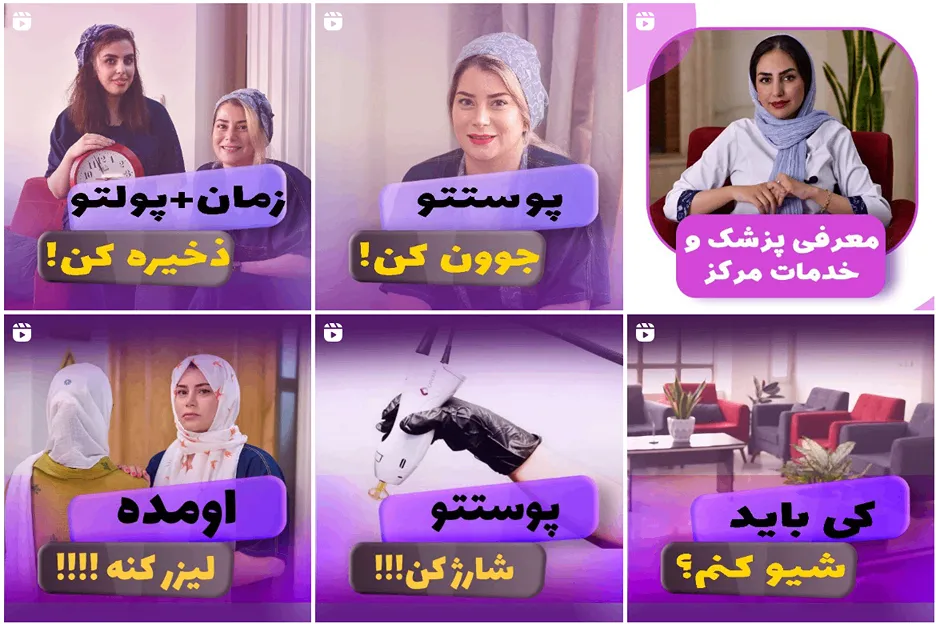 کاشت مو اصفهان در کلینیک ادریس کاملا قابل انجام است