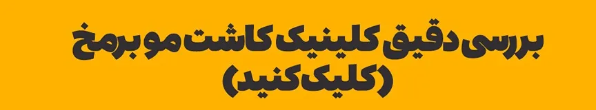 کاشت م اراک در کلینیک کاشت مو برمخ کاملا قابل انجام است