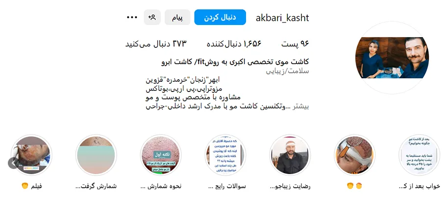 کاشت مو در زنجان توسط دکتر اکبری کاملا قابل انجام است