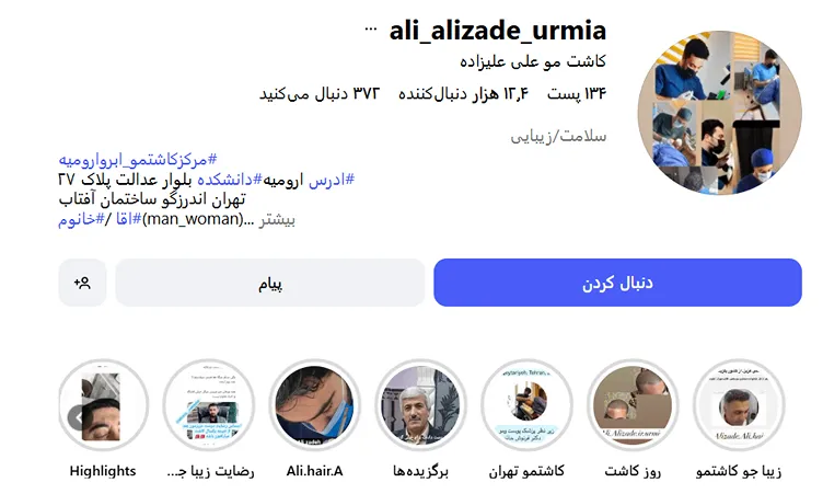 نمونه کار یکی از بهترین دکتر کاشت مو در ارومیه را مشاهده میفرمایید