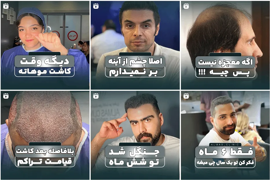 تصویر یکی از بهترین کلینیک کاشت مو در تبریز را مشاهده میفرمایید.