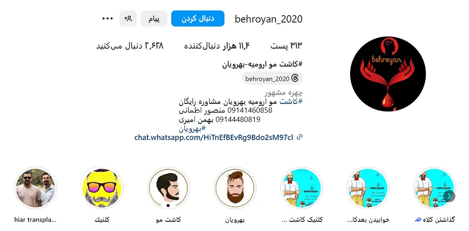 کاشت مو ارومیه توسط بهترین تکنسین ها قابل انجام است