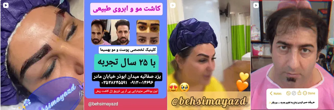 کلینیک بهسیما از بهترین کلینیک کاشت مو یزد است