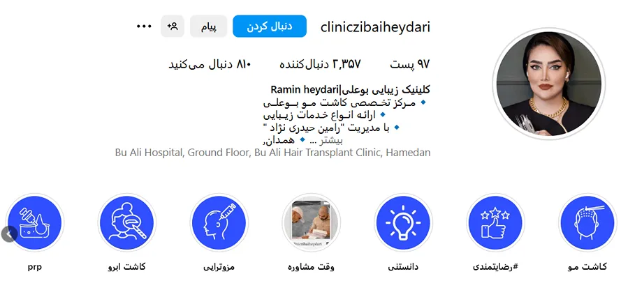 کاشت مو در همدان کلینیک بوعلی کاملا قابل انجام است