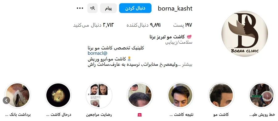 تصویر یکی از بهترین کلینیک کاشت مو در تبریز را مشاهده مبفرمایید.