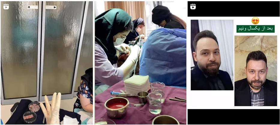 نمونه کار بهترین مرکز کاشت مو در تبریز را مشاهده میفرمایید.