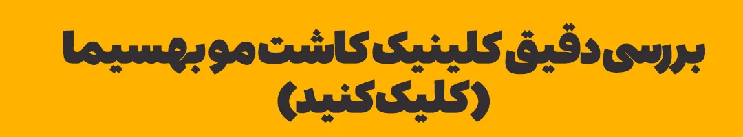 کاشت مو در همدان در کلینیک تخصصی بهسیا کاملا قابل انجام است
