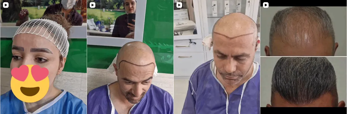 رویا امامی یکی از بهترین دکتر کاشت مو در اردبیل است