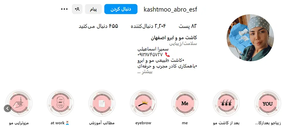 تصویر یکی از بهرتین دکتر کاشت مو در اصفهان را مشاهده میفرمایید