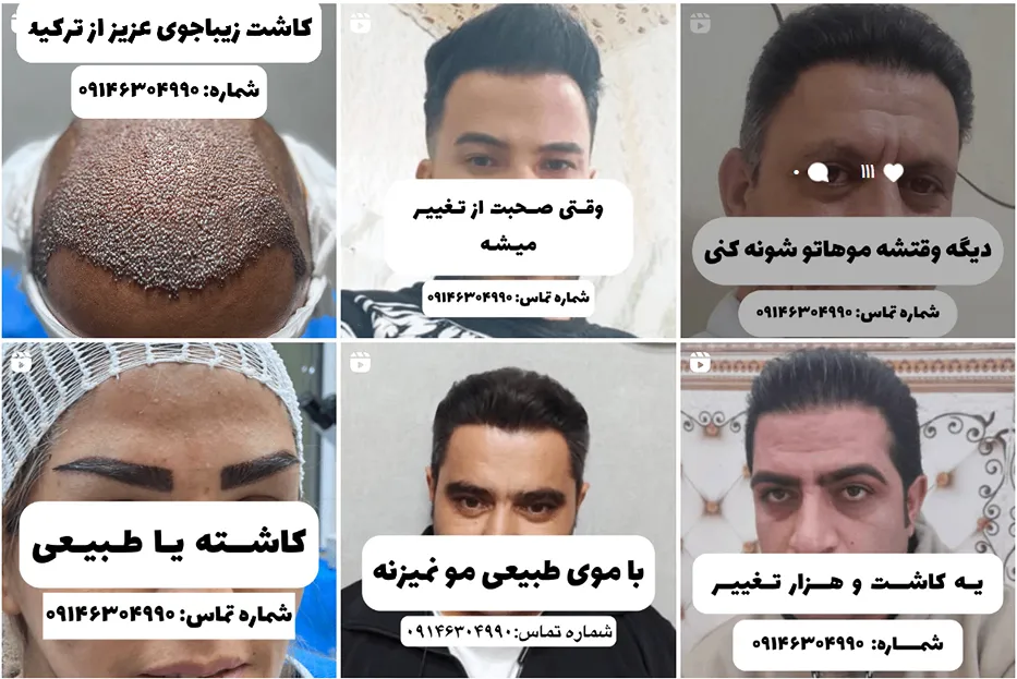 تصویر یکی از بهترین کلینیک کاشت مو در تبریز را مشاهده میفرمایید.