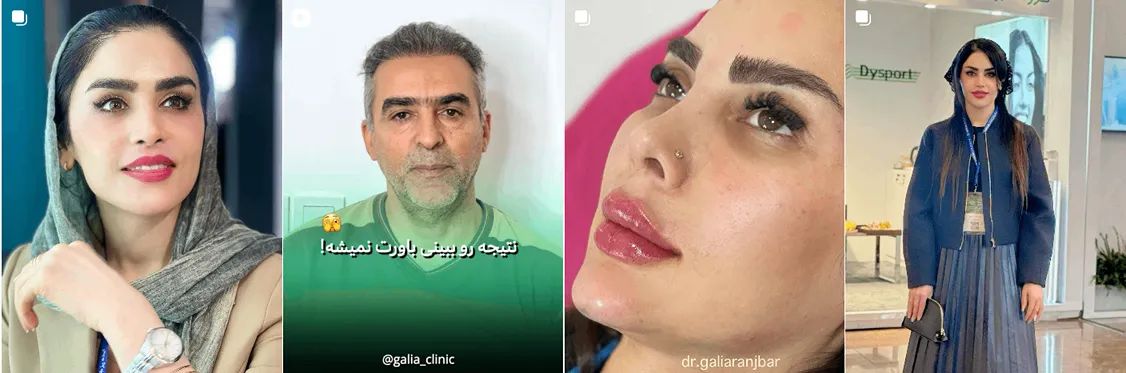 کاشت مو ساری توسط دکتر گالیا رنجبر کاملا قابل انجام است