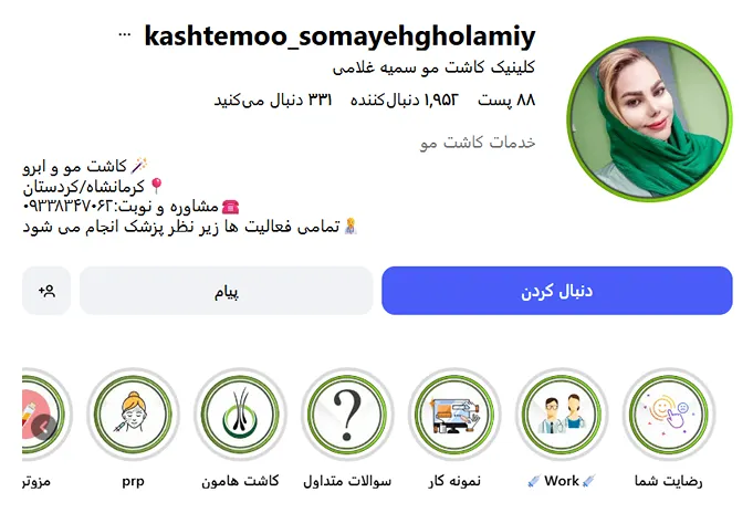 نمونه کار یکی از بهرتین دکتر کاشت مو در کرمانشاه را مشاهده میفرمایید.