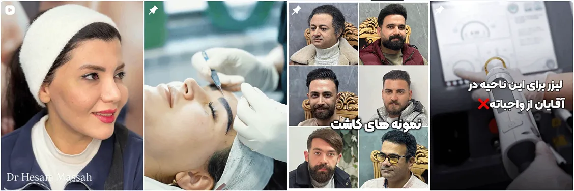 کلینیک جکیمان از بهترین کلینیک کاشت مو در تبریز است