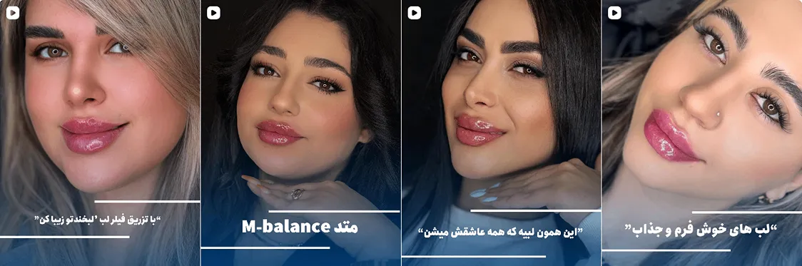 کاشت مو قزوین در کلینیک زیبایی هلیا کاملا قابل رزرو و انجام است