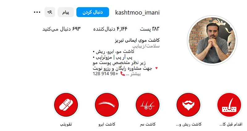 کاشت مو تبریز توسط تیم تخصصی ایمانی کاملا قابل انجام است