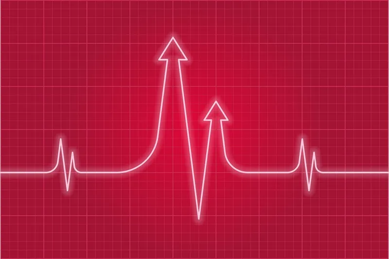 ورزش پرفشار بعد از کاشت مو موجب افزایش ضربان قلب در فرد میشود