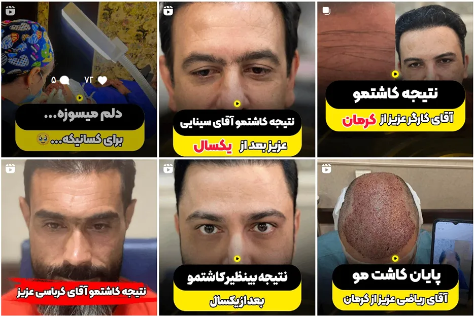 تصویر یکی از بهرتین کلینیک کاشت مو در کرمان را مشاهده میفرمایید.