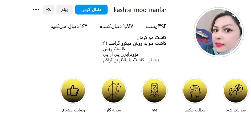 کاشت مو در کرمان توسط خانم الهام ایرانفر کاملا قابل انجام است