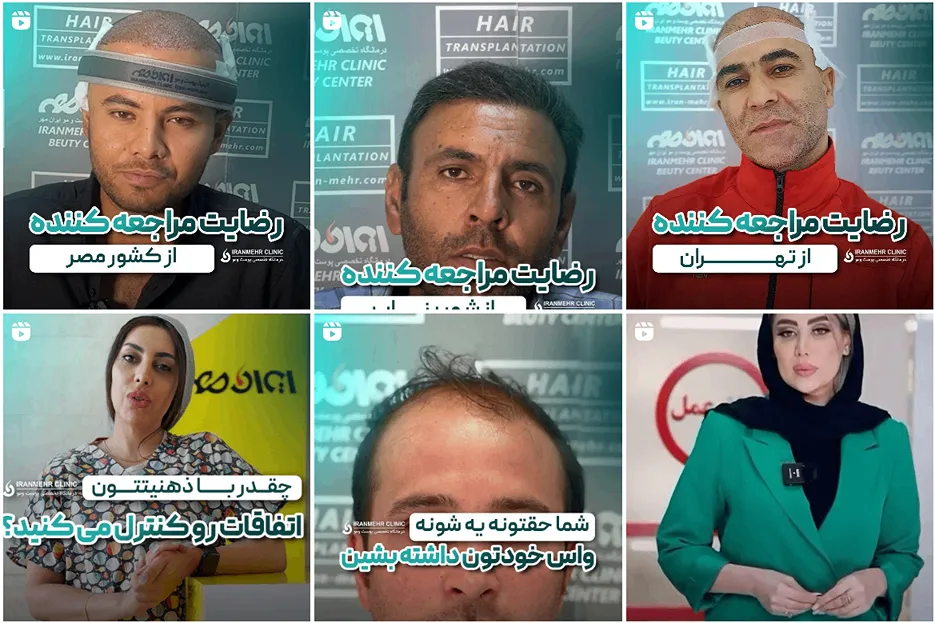 کلینیک ایرانمهر یکی از بهترین کلینیک کاشت مو تبریز است