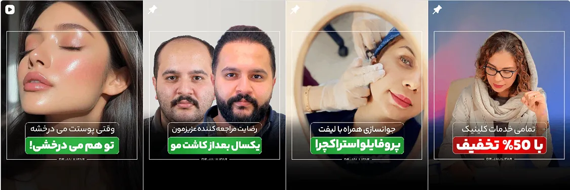 نمونه کار یکی از بهترین دکتر کاشت مو در اردبیل را مشاهده میفرمایید.