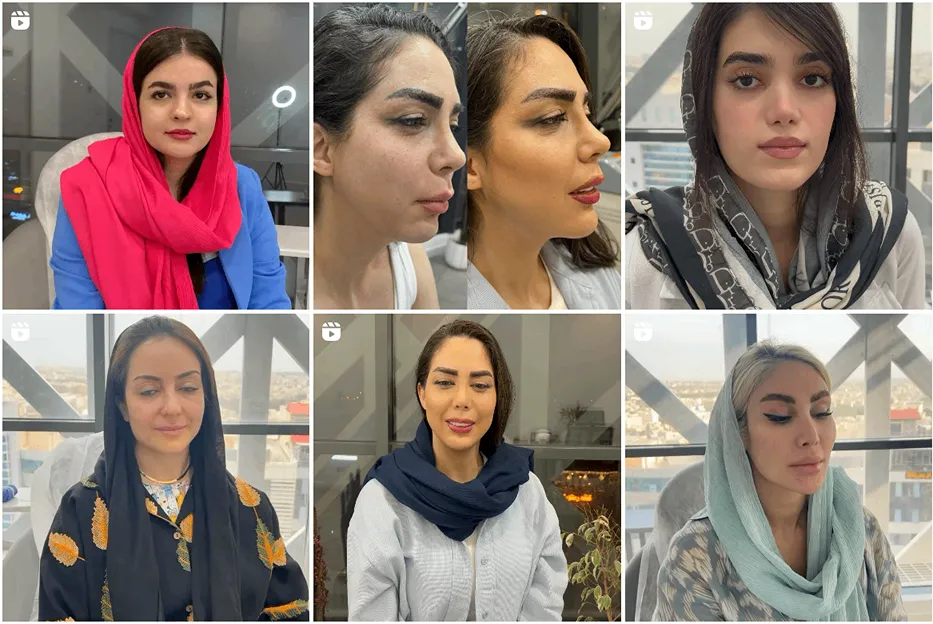 کاشت مو در کرج توسط دکتر جسری کاملا قابل انجام است