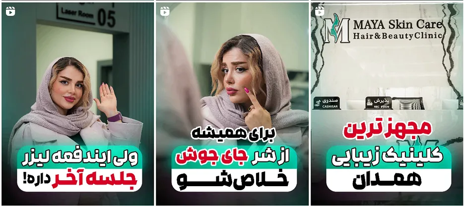 نمونه کار یکی از بهترین کلینیک کاشت مو در همدان را در اینجا میتوانید مشاهده بفرمایید.