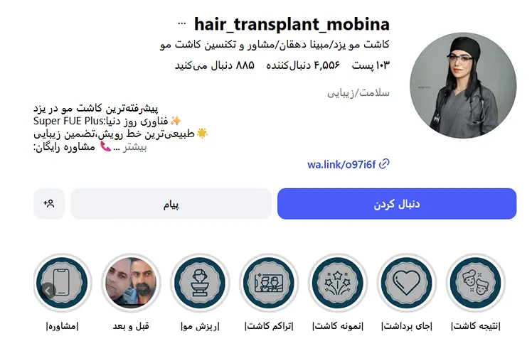 مبینا دهقان از بهترین دکتر کاشت مو در یزد است