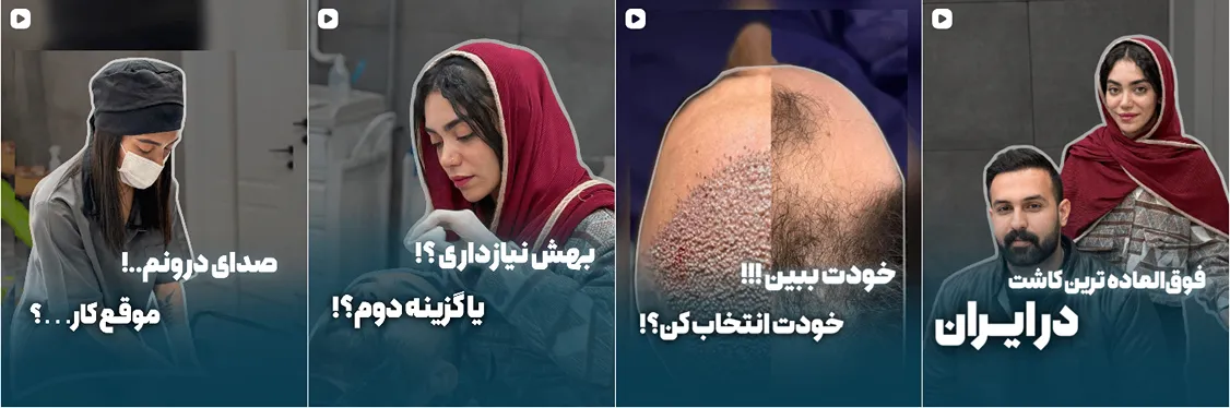 مبینا دهقان از بهترین دارند های کلینیک کاشت مو یزد است