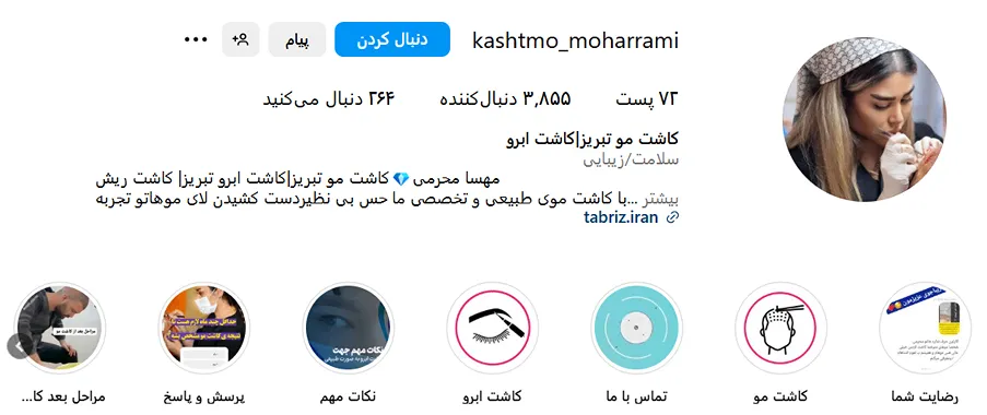 خانم محرمی از بهترین دکتر کاشت مو در تبریز است