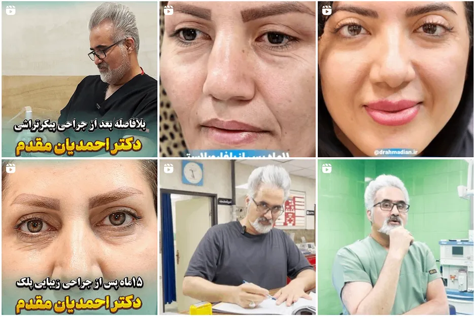 دکتر احمدیان مقدم یکی از بهرتین دکتر کاشت مو در زنجان است