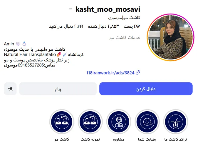 کاشت مو در کرمانشاه در کلینیک دکتر موسوی کاملا قابل انجام است