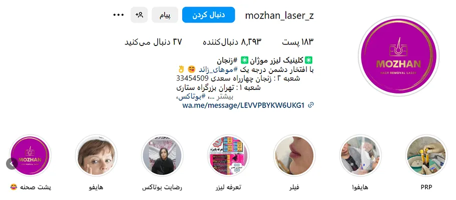 کاشت مو زنجان توسط کلینیک موژان کاملا قابل انجام است