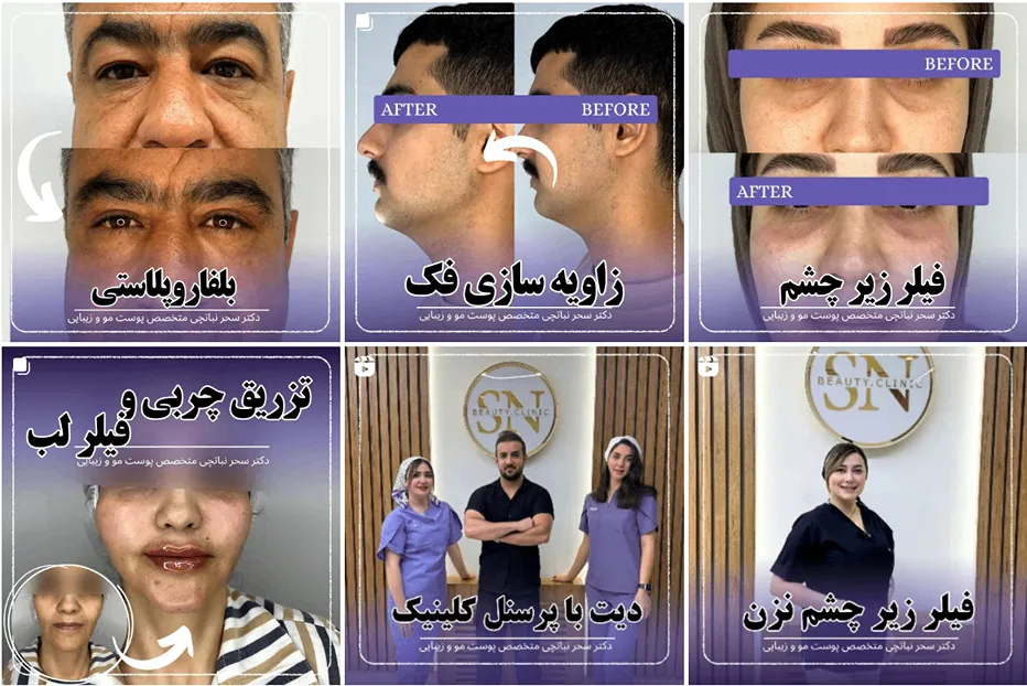 کاشت مو زنجان توسط دکتر سحر نبات چی کاملا قابل انجام است