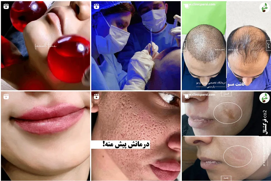 تصویر یکی از بهترین کلینیک کاشت مو در اصفهان را مشاهده میفرمایید.