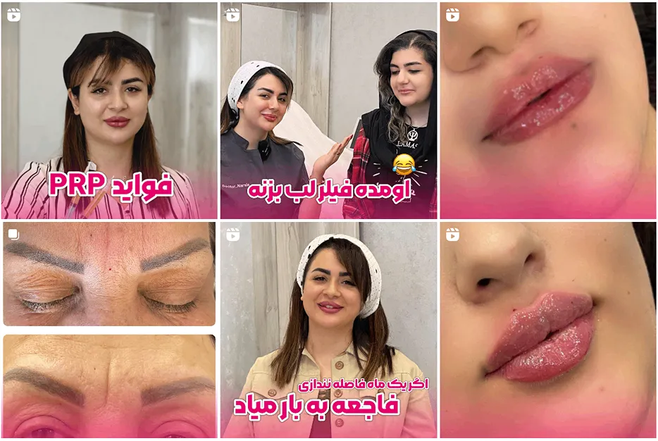 کلینیکروناک از بهترین کلینیک کاشت مو در زنجان است