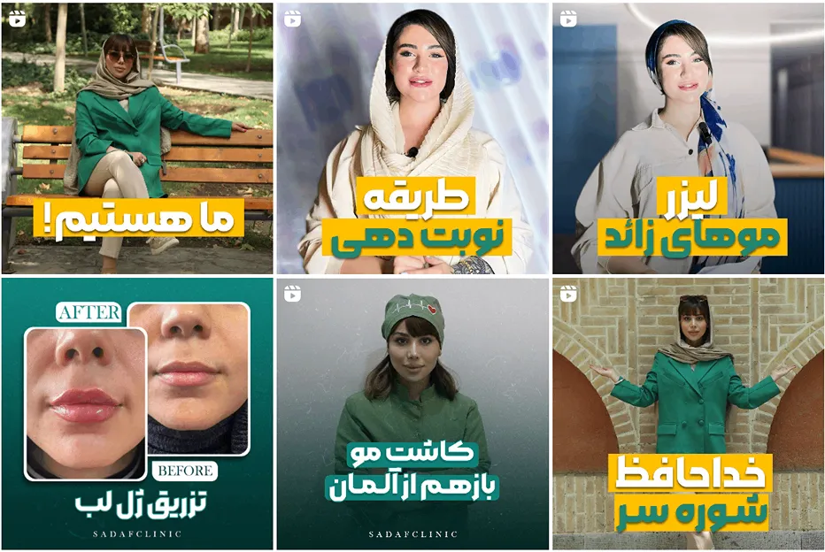 کلینیک صدف از بهرتین کلینیک کاشت مو در اصفهان است