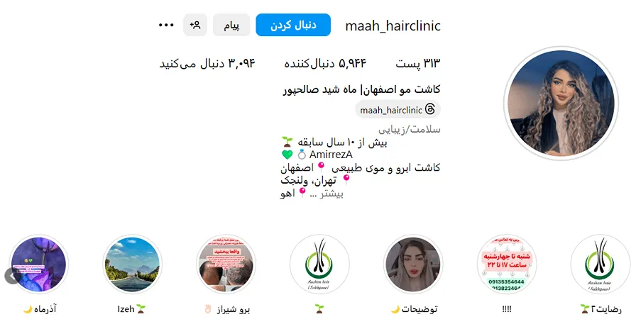 کاشت مو اصفهان توسط خانم صالحپور کاملا قابل انجام است