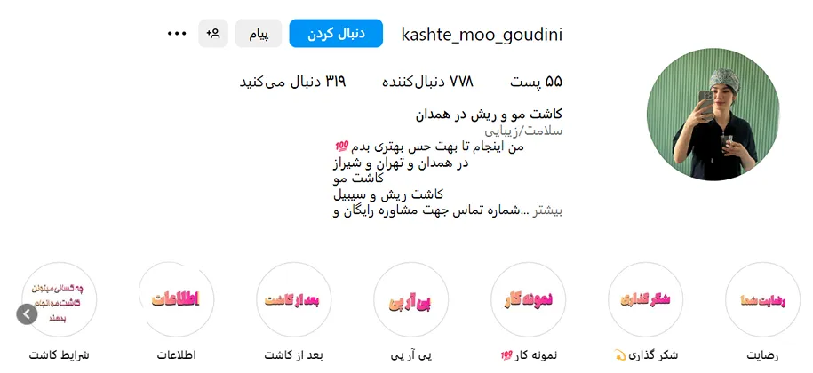 تصویر یکی از بهترین دکتر کاشت مو در همدان را مشاهده میفرمایید.