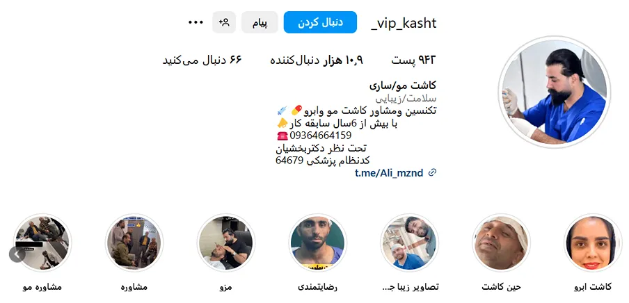 تصویر یکی از بهترین دکتر کاشت مو در ساری را مشاهده میفرمایید.