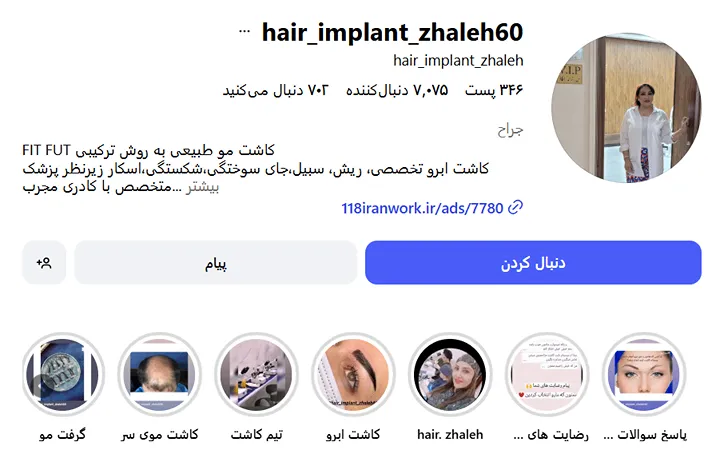 کاشت مو در کرمان در کلینیک زیبایی ژاله کاملا قابل انجام است