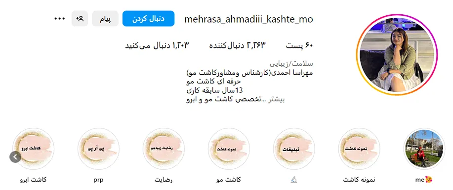 کاشت مو در ساری توسط بهتری متخصصین کاملا قابل انجام است