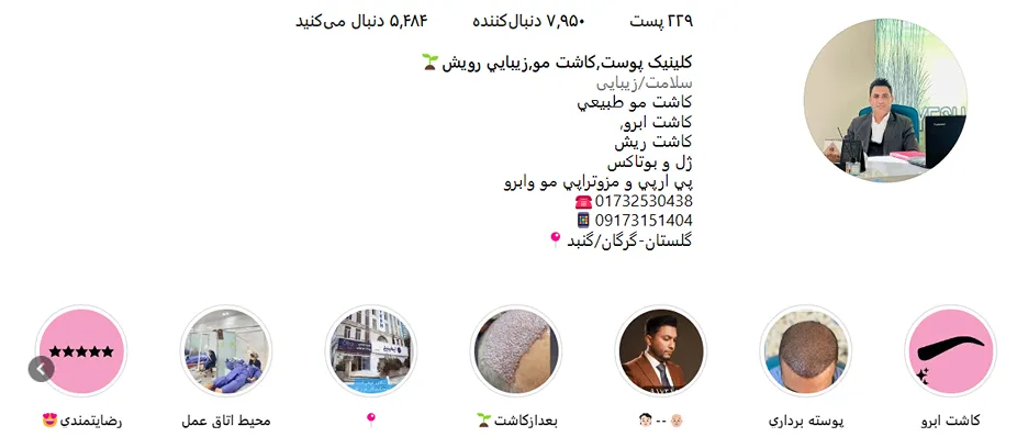 کاشت مو طبیعی در گرگان و در کلینیک رویش قابل انجام است