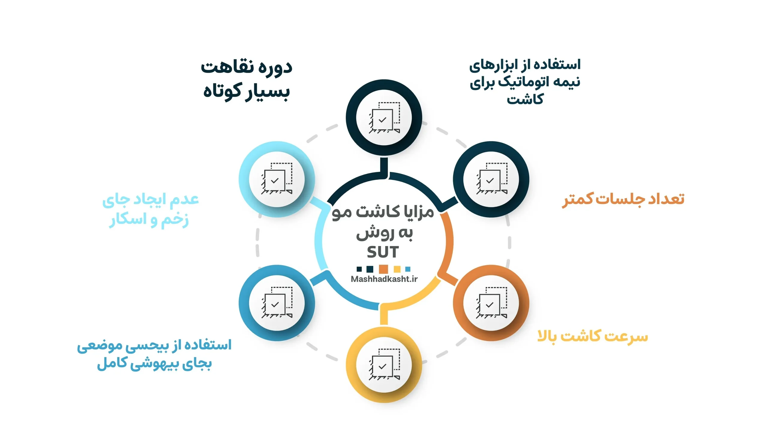 اینفوگرافیک مزایای کاشت مو به روش SUT