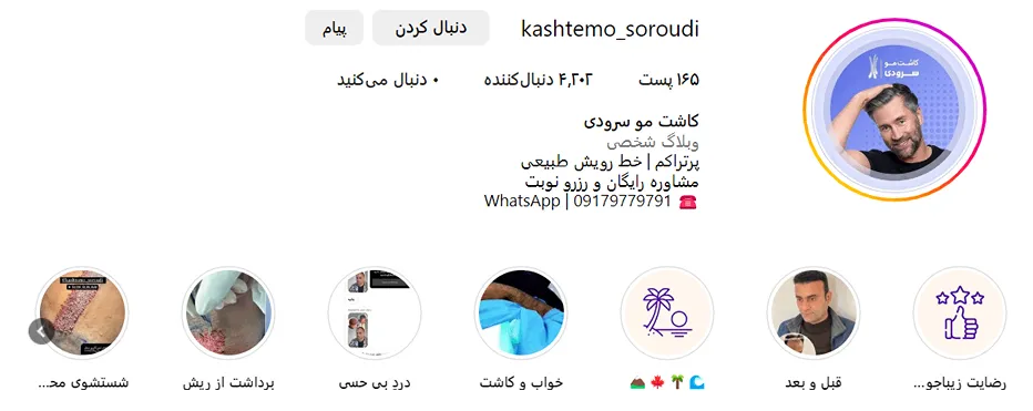 کاشت مو طبیعی در بندرعباس برای مجعین کاملا در دسترس قرار دارد.