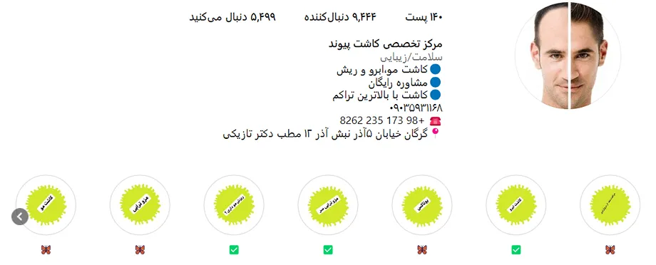 هزینه کاشت مو در گرگان را عوامل و فاکتورهای متعددی تعیین میکنند