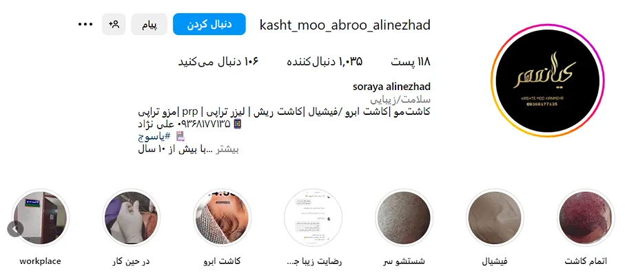 دکتر علینژاد از بهترین دکتر کاشت مو یاسوج است