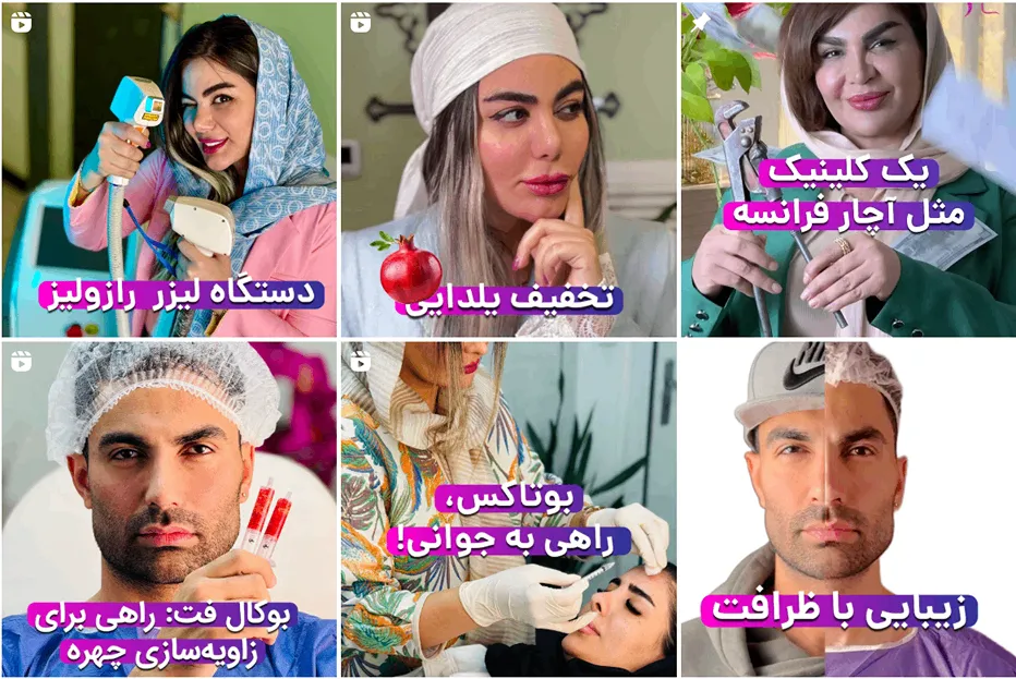 کاشت مو در مشهد در کلینیک آنجل کاملا قابل انجام است