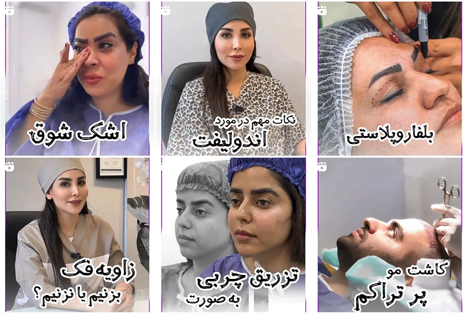 کلینیک ارارز از بهترین کلینیک کاشت مو مشهد اقساطی است